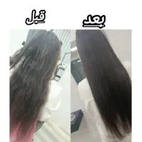 موخوره گیری مو