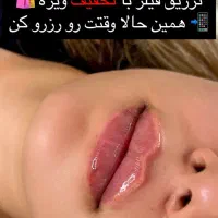 جشنواره تزریق ژل و لیفت صورت|خدمات آرایشگری و زیبایی|قم, زنبیل آباد|دیوار