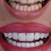 استخدام دستیار دندانپزشک