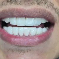 کامپوزیت درجه یک با شرایط پرداخت