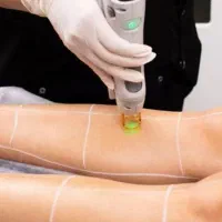 جشنواره مرکز کلینیک لیزر