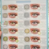 لنزدهب تک و عمده طبق کاتالوگ ۴۵۰