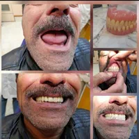 دندانسازی /دندان متحرک /دندان مصنوعی|خدمات آرایشگری و زیبایی|مشهد, حرم مطهر رضوی|دیوار