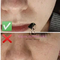 فیشال تخصصی پوست آقایان و بانوان|خدمات آرایشگری و زیبایی|گلبهار, شهر جدید گلبهار|دیوار