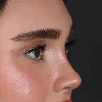 جراحی بینی|خدمات زیبایی و سلامت|تهران, امام خمینی|دیوار