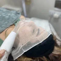 تخفیف فیشال صورت به مناسبت یلدا