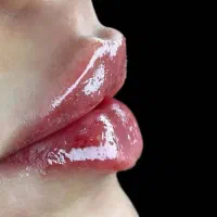تخفیف استثنایی بلفاروپلاستی،بوکال فت،ساکشن غبغب|خدمات آرایشگری و زیبایی|تهران, فرمانیه|دیوار