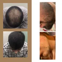 رفتار همه باهات عوض میشه