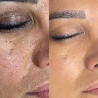 جوانسازی ،درمان پوست ،فیشال،پاکسازی،پوست کره ای|خدمات آرایشگری و زیبایی|شیراز, قدوسی غربی|دیوار