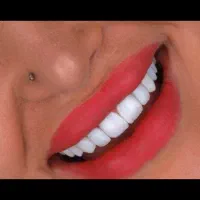 کامپوزیت دندان|خدمات آرایشگری و زیبایی|آبادان, |دیوار