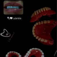 ساخت دندان مصنوعی|خدمات آرایشگری و زیبایی|اردبیل, |دیوار