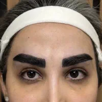 پر پشتی ابرو بدون جراحی