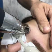 پاک کردن تتو،کربن تراپی،لیزر موهای زائد،کربوکسی