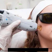 لیزر موهای زائد غیرتماسی کندلا