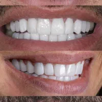 اطفال و نوجوان دندانپزشککی
