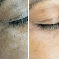 کرم معجزه اصلی