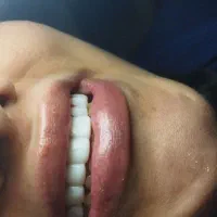 آموزش و خدمات کامپوزیت