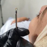 دستگاه فشیال درما پلنینگ . پاکسازی و آبرسانی|آرایشی، بهداشتی، درمانی|زابل, |دیوار