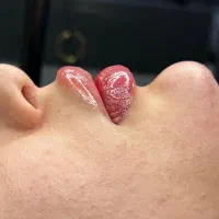 آموزش تخصصی ژل وبوتاکس و مزوتراپی توسط متخصص|خدمات آموزشی|کرج, گلشهر|دیوار