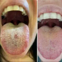 درمان با طب سنتی|خدمات آرایشگری و زیبایی|یاسوج, |دیوار