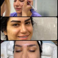تخصصی ترین کاشت ابرو /مو/ریش شیرازی