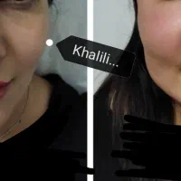 تزریق چربی ، فیلر بادی، ژل، بوتاکس در مطب|خدمات آرایشگری و زیبایی|شیراز, گویم|دیوار