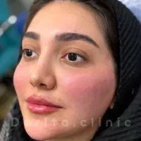 فیلر، بوتاکس، پی آر پی در کلینیک زیبایی توسط پزشک