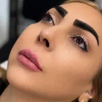 لیزر فیلر بوتاکس مزو ژل|خدمات زیبایی و سلامت|تهران, قلهک|دیوار
