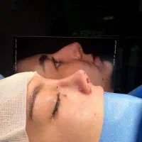 لیپو ابدوتزریق،لیفت سینه،ماموپلاستی