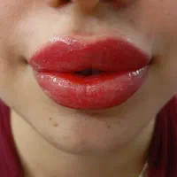 مدل برای تتوی بدن،میکروبلیدینگ،ریموو تتو|خدمات زیبایی و سلامت|رشت, دیلمان|دیوار