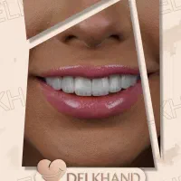 کامپوزیت تمام اقساط