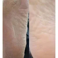پدیکور