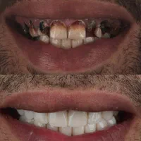 مناسب ترین قیمت دندانپزشکی در استان باسه سال ضمانت|خدمات آرایشگری و زیبایی|یاسوج, |دیوار