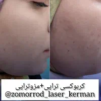 کلینیک پوست،مو،لیزر،لاغری و کربوکسی تراپی|خدمات آرایشگری و زیبایی|کرمان, |دیوار