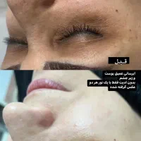 پاکسازی صورت ۲۵۰ تومن|خدمات آرایشگری و زیبایی|لاهیجان, کوی استادان|دیوار