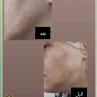 سارا محمدپور هستم|آرایشی، بهداشتی، درمانی|تهران, آزادشهر|دیوار