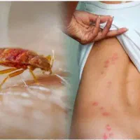 سمپاشی تخصصی،سم پاشی کلیه حشرات ساس سوسک باضمانت