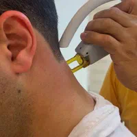 لیزرموهای زائدبادستگاه کندلاآمریکایی کلینیک راویس|خدمات آرایشگری و زیبایی|کاشان, رجایی|دیوار