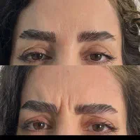 تزریق بوتاکس وژل فقط قیمت مواد|خدمات آرایشگری و زیبایی|اهواز, ۲۴ متری|دیوار