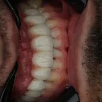 جشنواره کلیه خدمات دندانپزشکی با اقساط ۱۵ ماهه|خدمات آرایشگری و زیبایی|تبریز, |دیوار