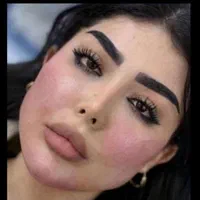 جشنواره ژل بوتاکس.فیلرلیفت نخ.بوتاکس.انزیم.پی ارپی|خدمات آرایشگری و زیبایی|مشهد, سناباد|دیوار