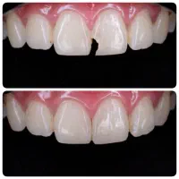 خدمات دندانپزشکی با قیمت مناسب|خدمات آرایشگری و زیبایی|تهران, مینابی|دیوار