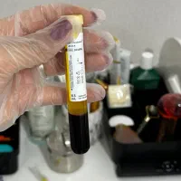 جوانسازی صورت، دست وقطع ریزش مو با پی ار پی از 650