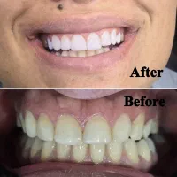 جشنواره دندانپزشکی اقساطی بدون پیش پرداخت|خدمات آرایشگری و زیبایی|شیراز, ستارخان|دیوار