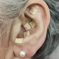 پی آر پی حجامت امبدینگ طب سوزنی زالو بادکش|خدمات آرایشگری و زیبایی|اصفهان, فروردین|دیوار