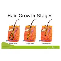 رویش مجدد مو تنظیم چربی کف سر درمان موخوره ونازکی