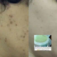 کرم فوق العاده عالی