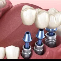 کلینیک دندانپزشکی بزرگمهر با تعرفه دولتی|خدمات آرایشگری و زیبایی|اهواز, شهرک حفاری|دیوار