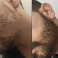 هنوز دنبال راه حلی