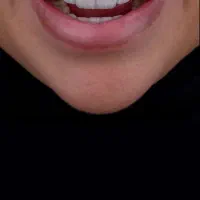 جراح دندانپزشک دکتر دانیال قشقایی|خدمات آرایشگری و زیبایی|کرمانشاه, |دیوار